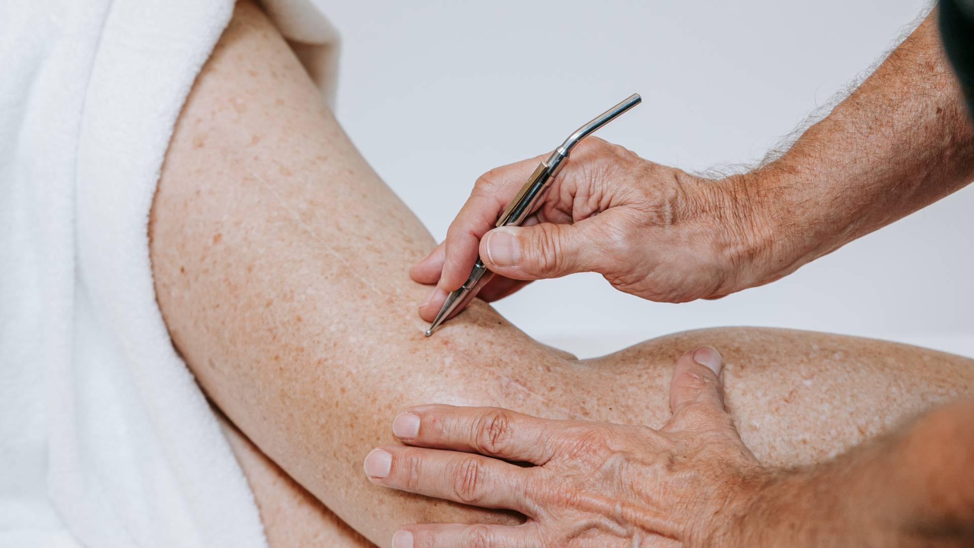 Eine Person erhält eine Behandlung der Haut am Bein.
